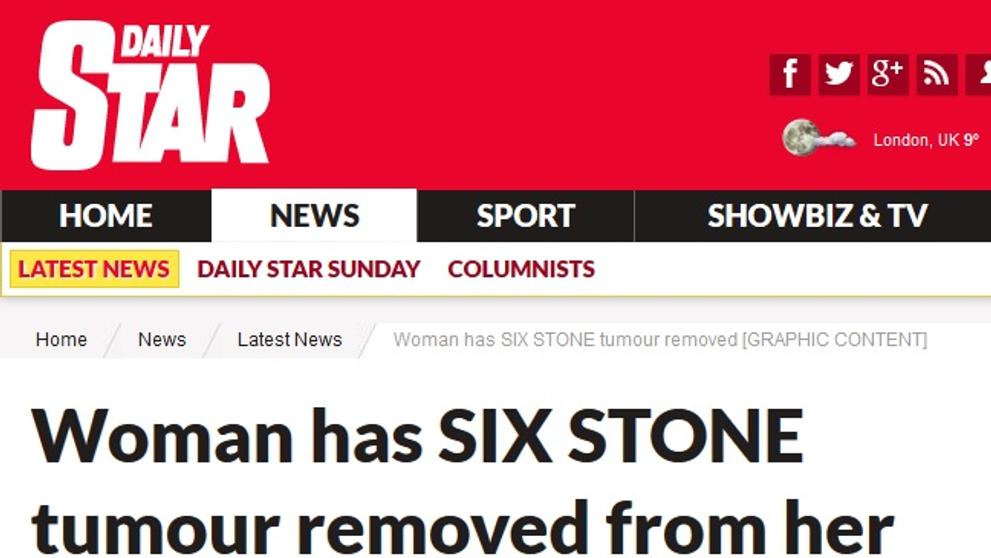 Obří nádor z Česka na DailyStaru