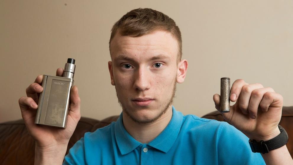 Mladíkovi se v kapse vznítila elektronická cigareta a popálila ho - 3