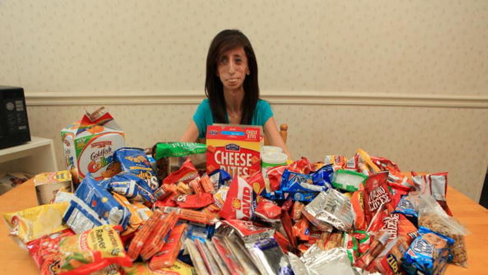 Lizzie Velasquezová - 4