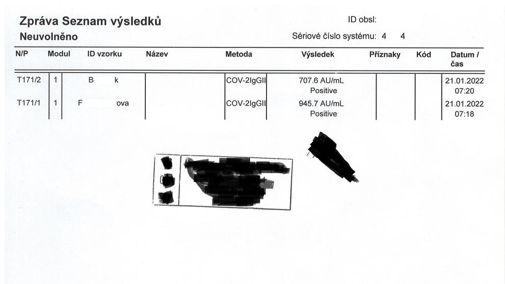 Protilátky covid-19