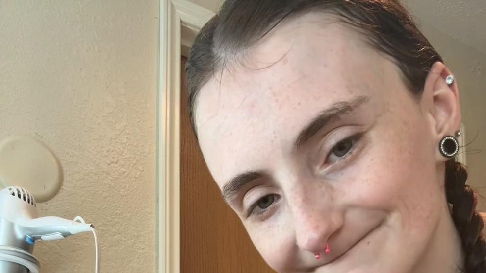 Žena přišla kvůli nedostatku vitamínů o všechny zuby
