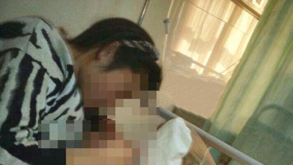 Žena manželovi dvakrát uřízla penis