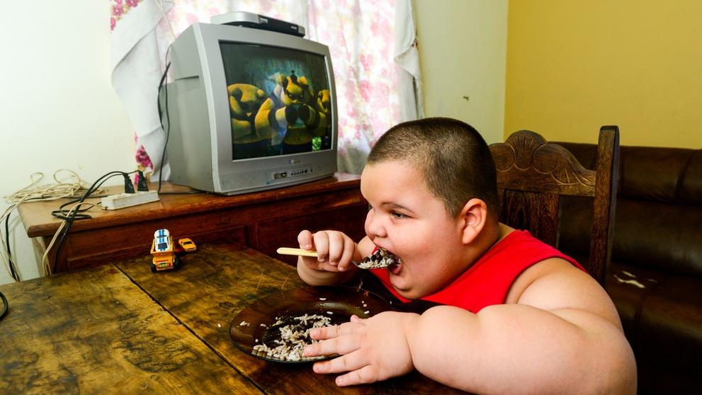 Pětiletý chlapec váží neuvěřitelných 80 kg - 2