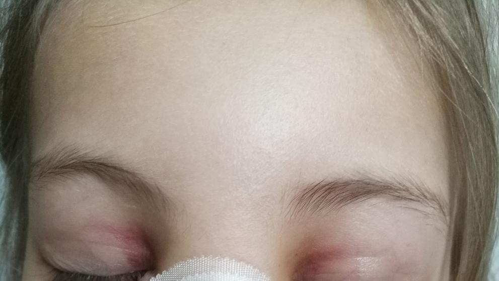 Holčička se ve škole zranila, učitelka jí podle matky nepřivolala pomoc - 3