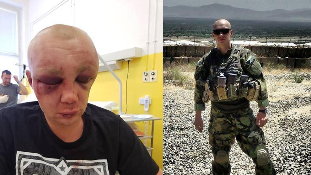 Zbitý voják u diskotéky Luna v Teplicích - 4