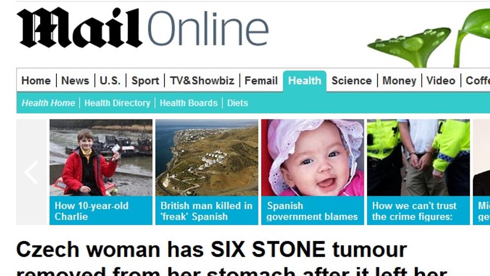 Obří nádor z Česka na DailyMailu