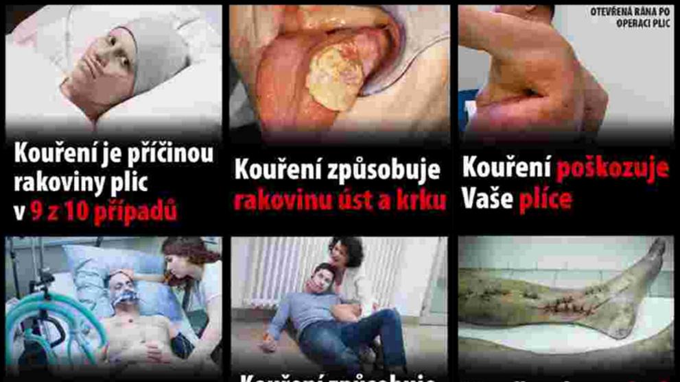 Nová varování na cigaretách - 3