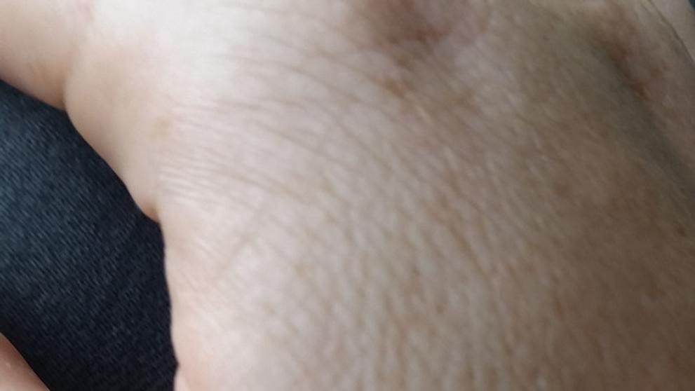 Ženě vzplála během letu sluchátka na hlavě