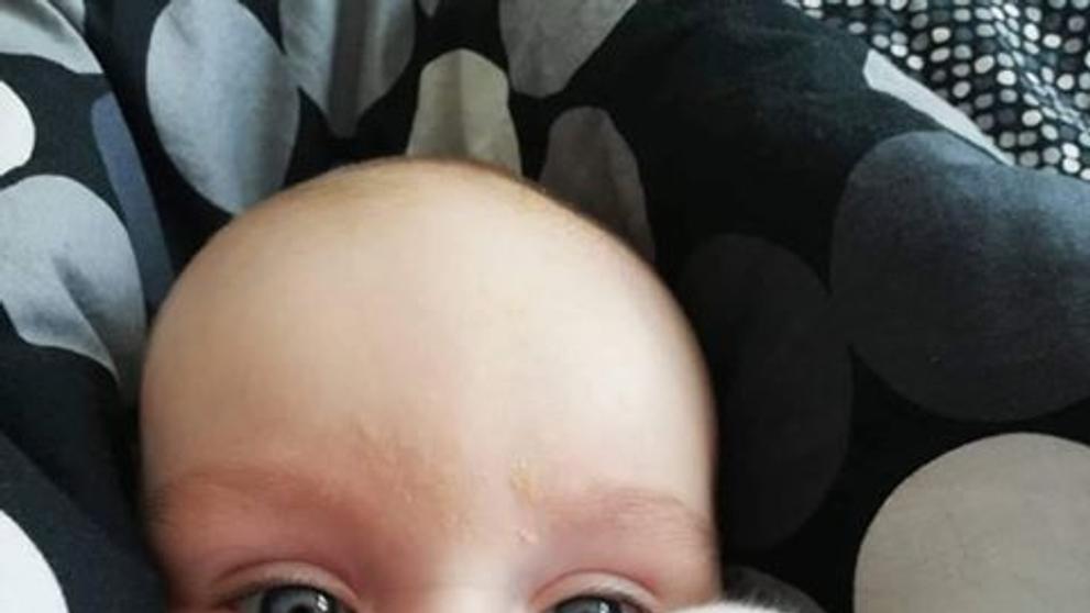 Půlroční Nikolka má vrozenou vadu, maminka shání peníze na auto a léčbu - 1