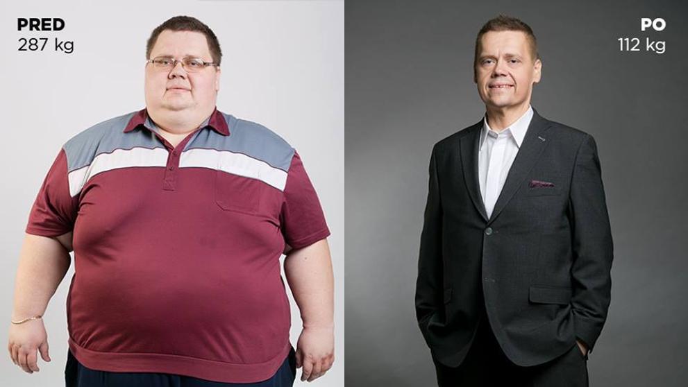 Slovák Ján zhubl za rok 175 kilo - 3