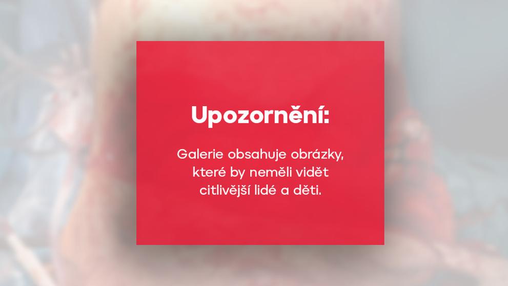 Upozornění