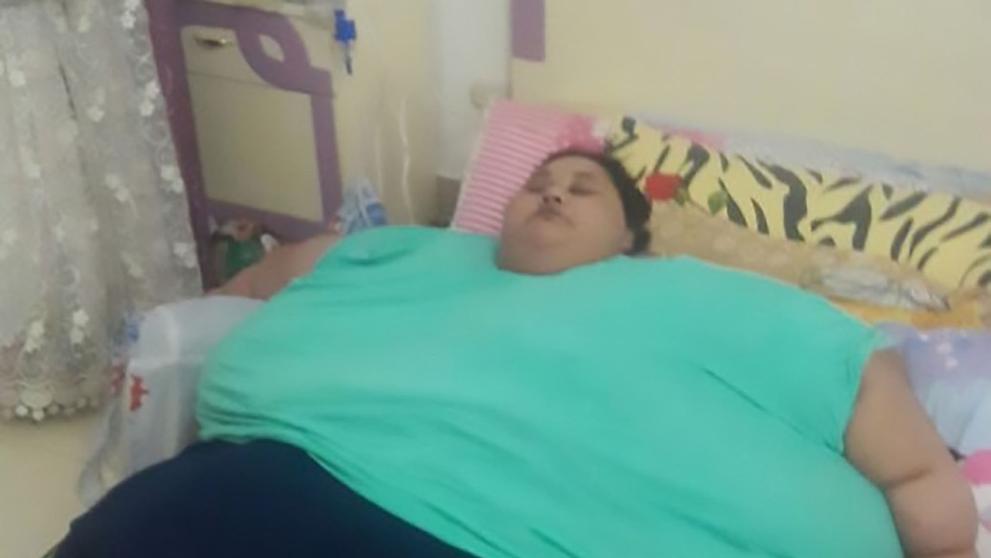 Ženu, která váží 500 kg čeká operace