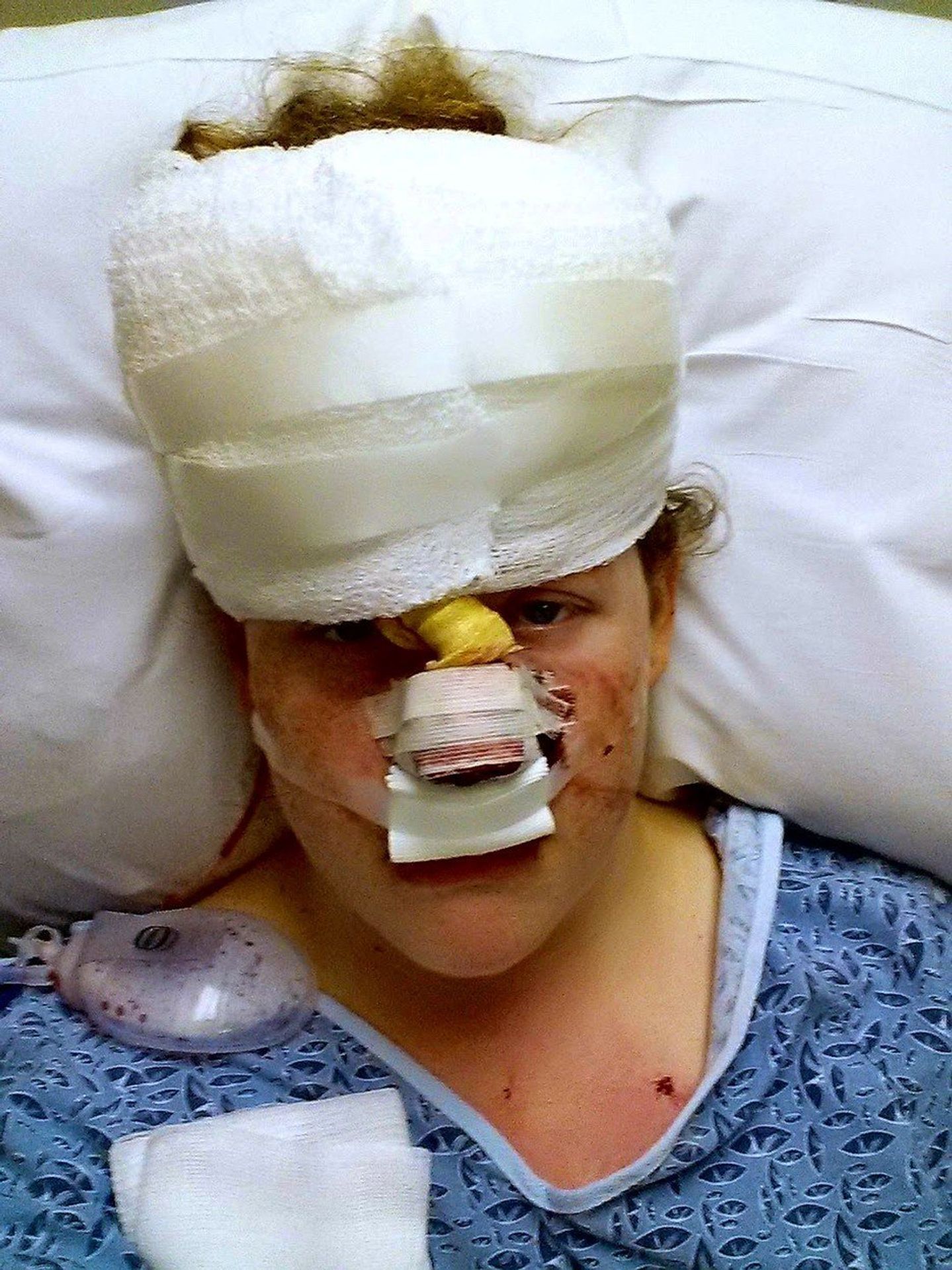 Marisha Dotson - z pupínku na nose byla rakovina - 3 - GALERIE: Marisha Dotson (2/4)