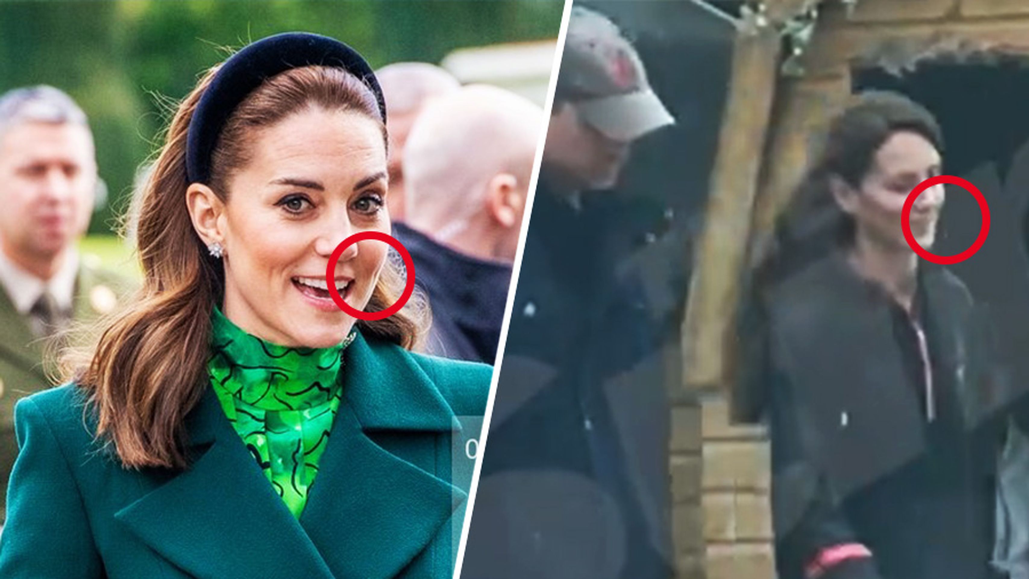 Princezna Kate, nesrovnalosti na fotografii (1) - Nesrovnalosti na fotografii (6/8)