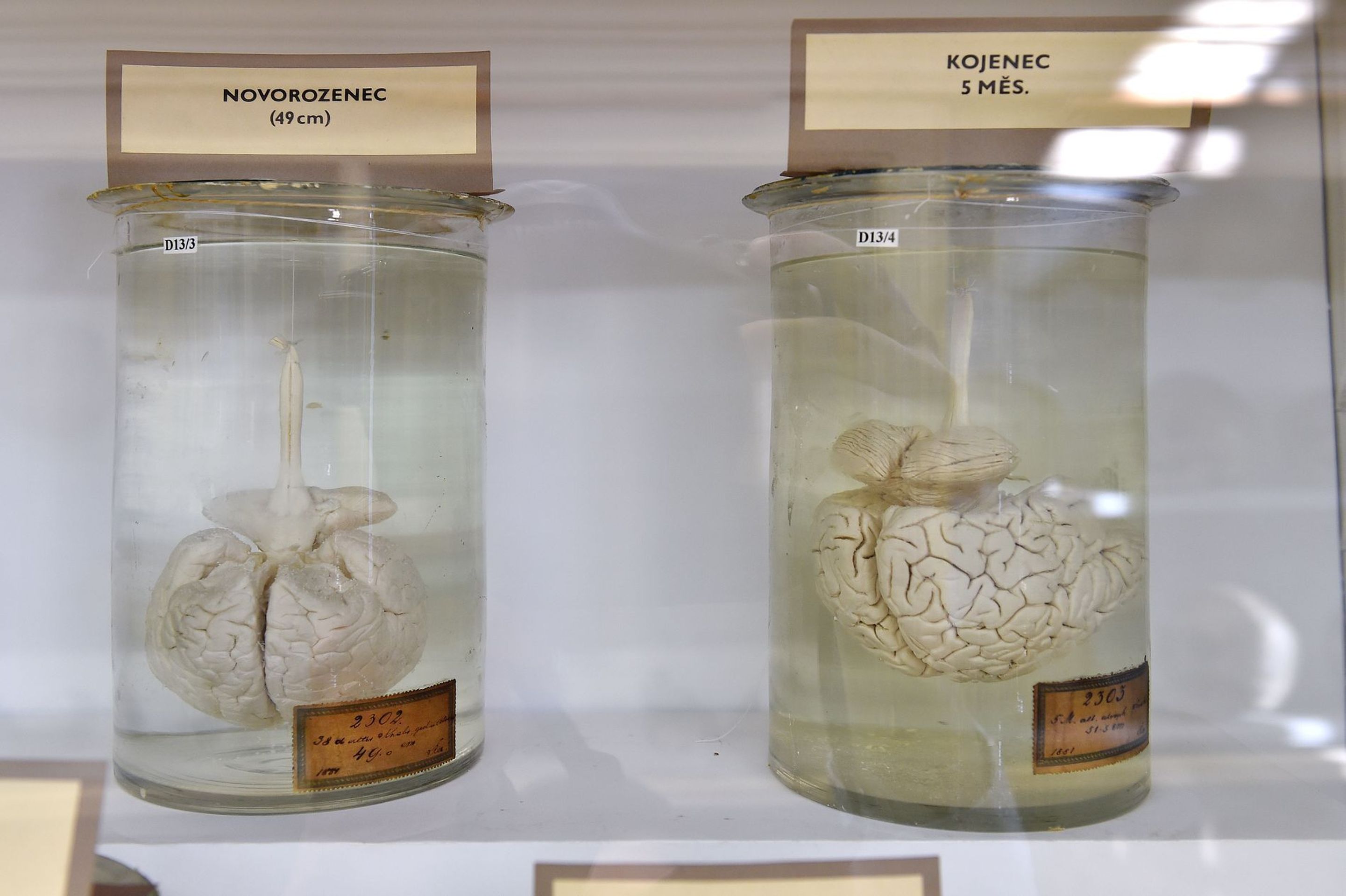 Muzeum normální a srovnávací anatomie - 12 - GALERIE: Muzeum normální a srovnávací anatomie (15/21)