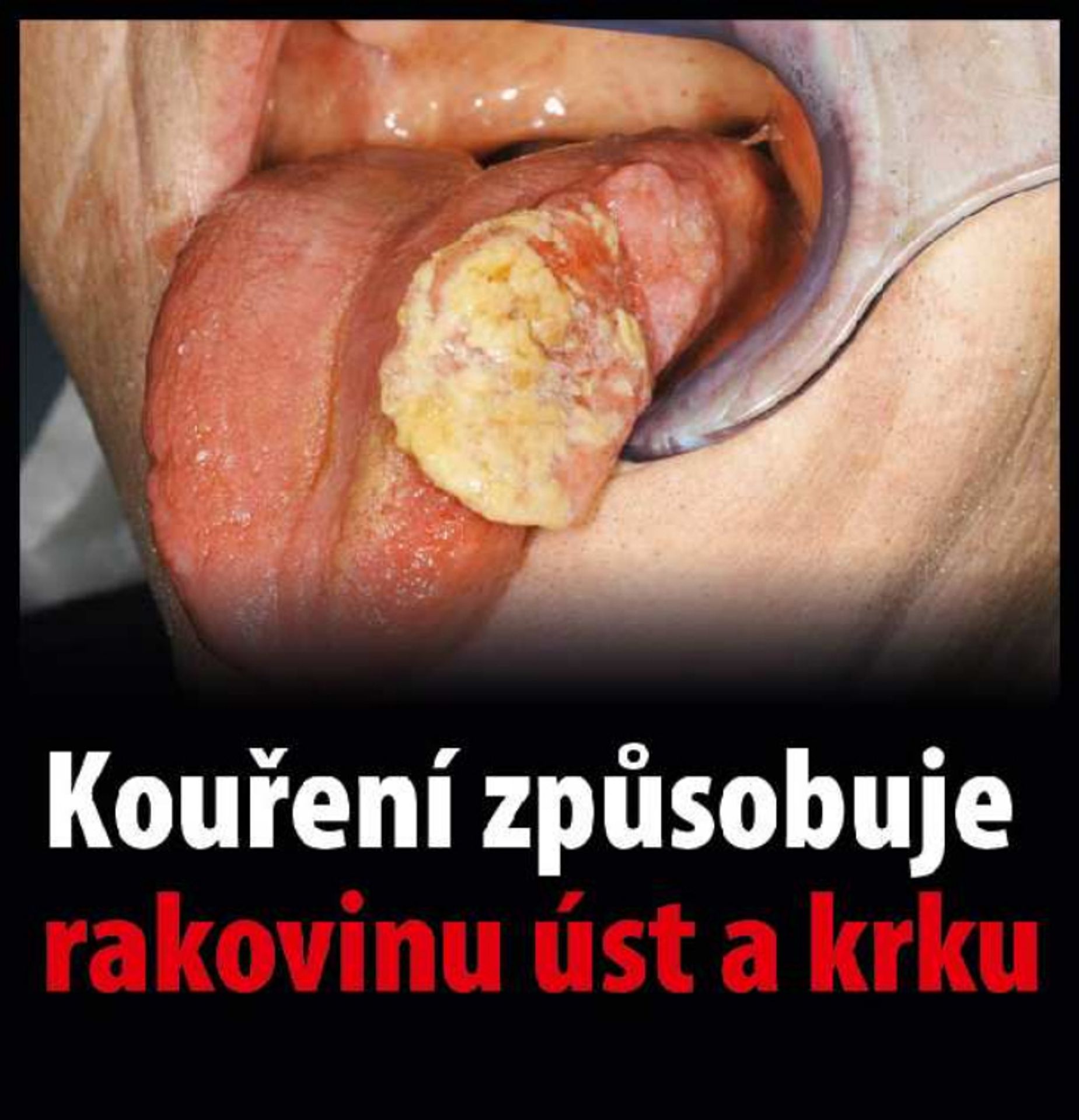 Varovné obrázky na krabičkách cigaret - 8 - GALERIE: Varovné obrázky na krabičkách cigaret (8/42)
