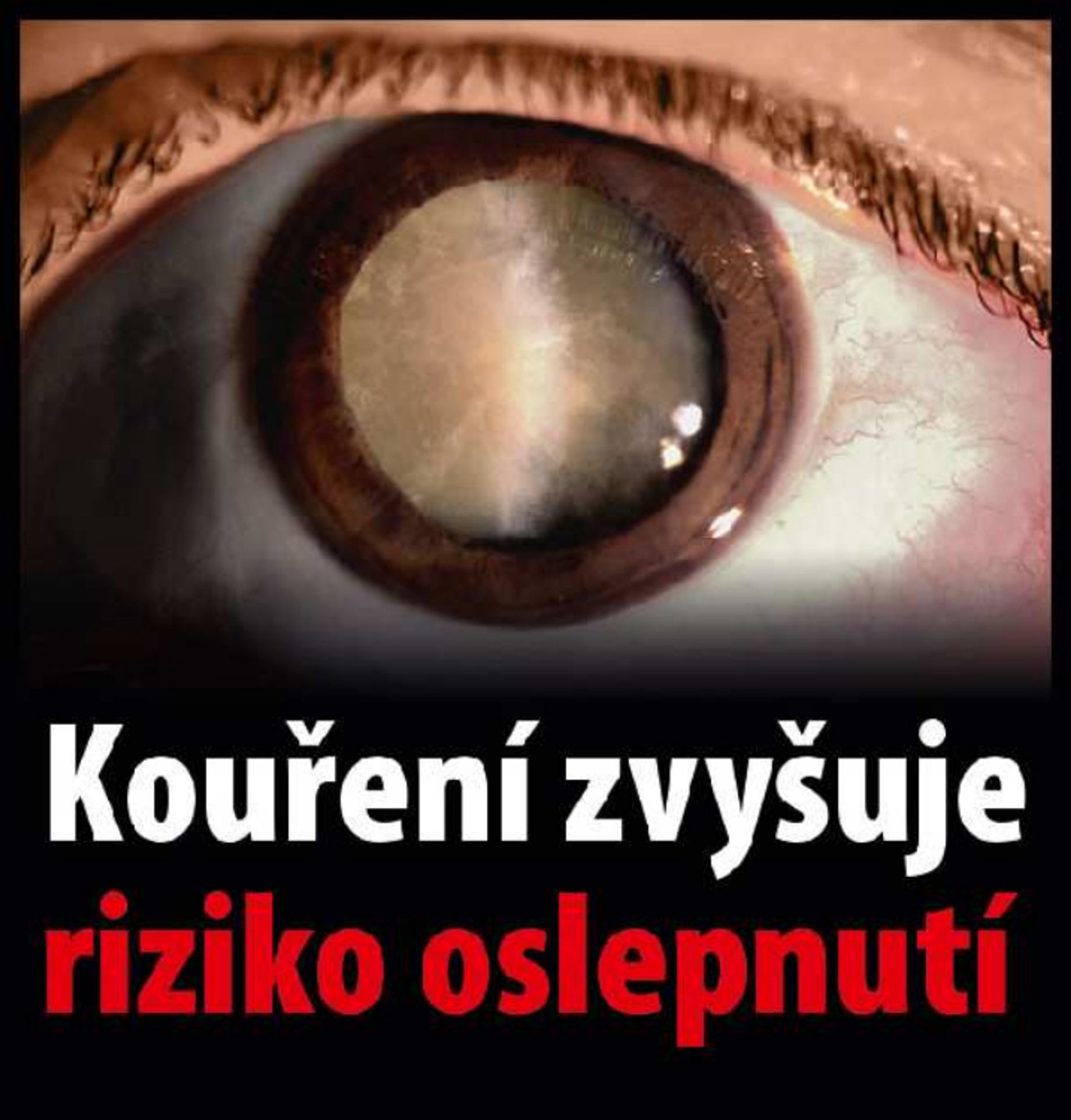 Varovné obrázky na krabičkách cigaret - 29 - GALERIE: Varovné obrázky na krabičkách cigaret (29/42)