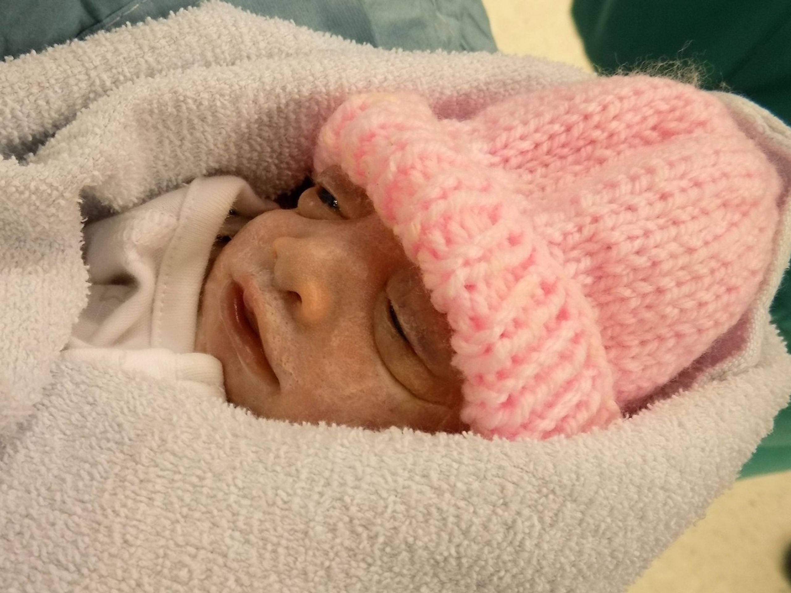 Malá Hope se stala nejmladší dárkyyní orgánů - 2 - GALERIE: Malá Hope se stala nejmladší dárkyní orgánů (5/6)