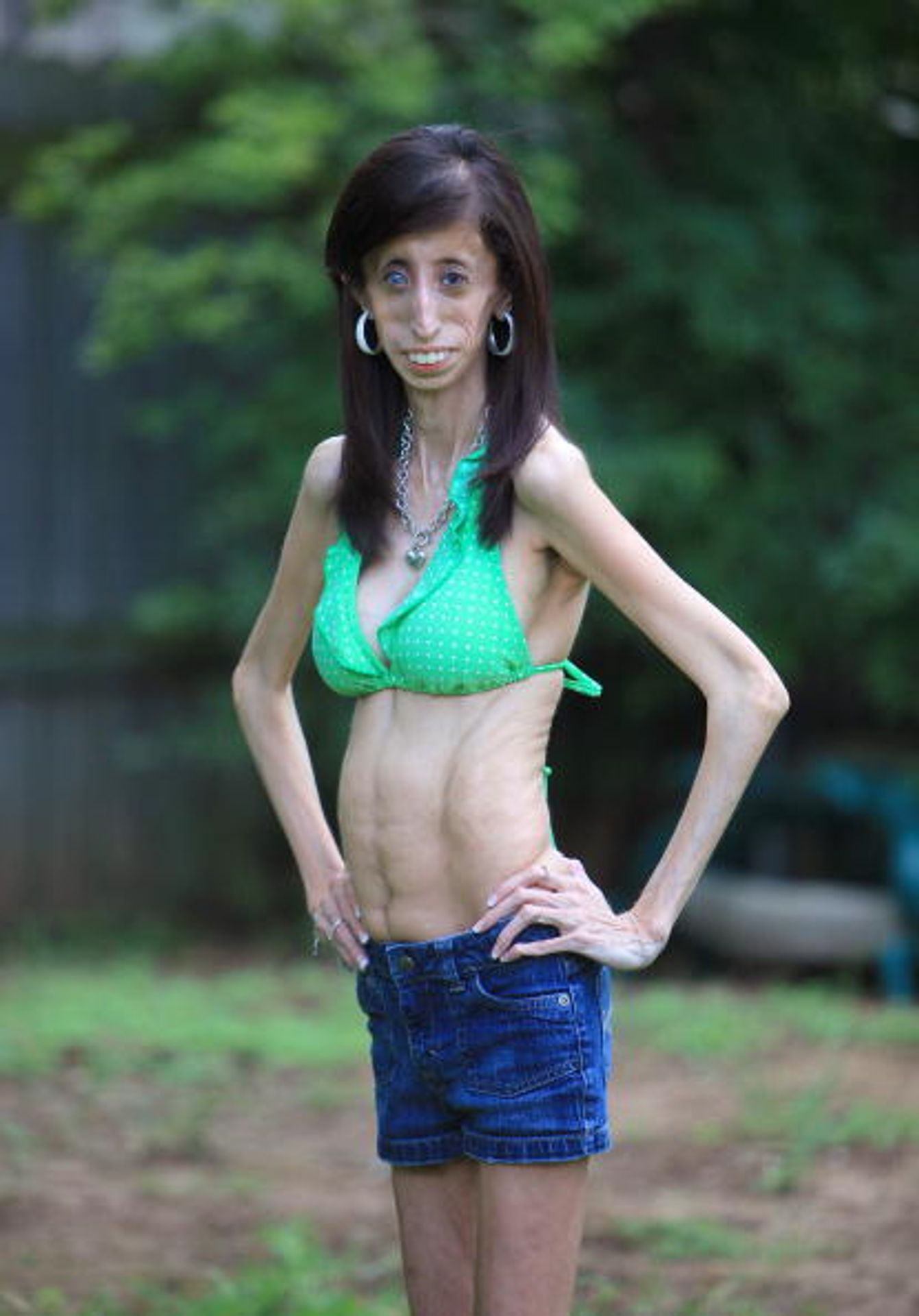 Lizzie Velasquezová - 8 - Lizzie Velasquez (5/7)