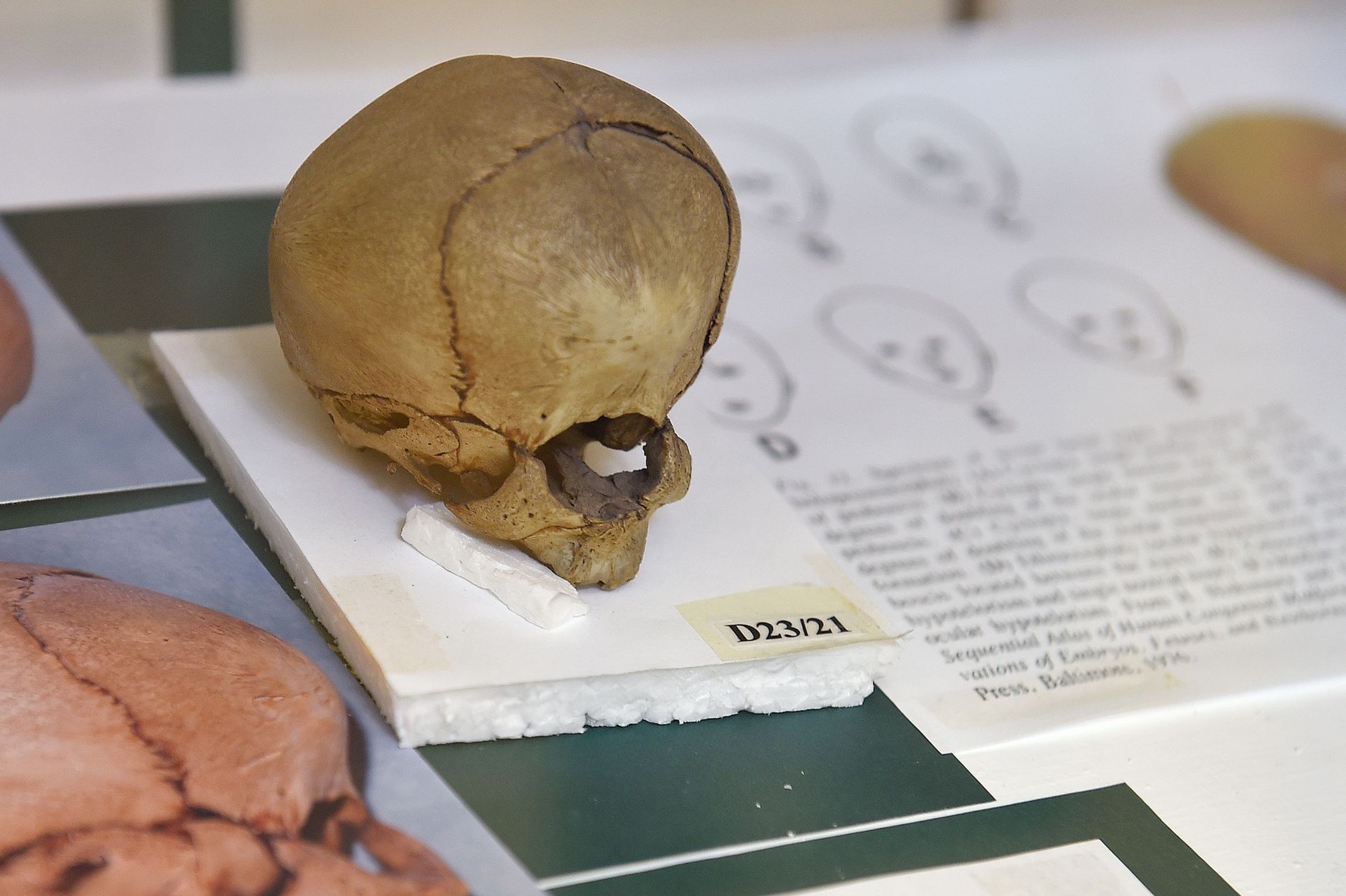 Muzeum normální a srovnávací anatomie - 4 - GALERIE: Muzeum normální a srovnávací anatomie (7/21)