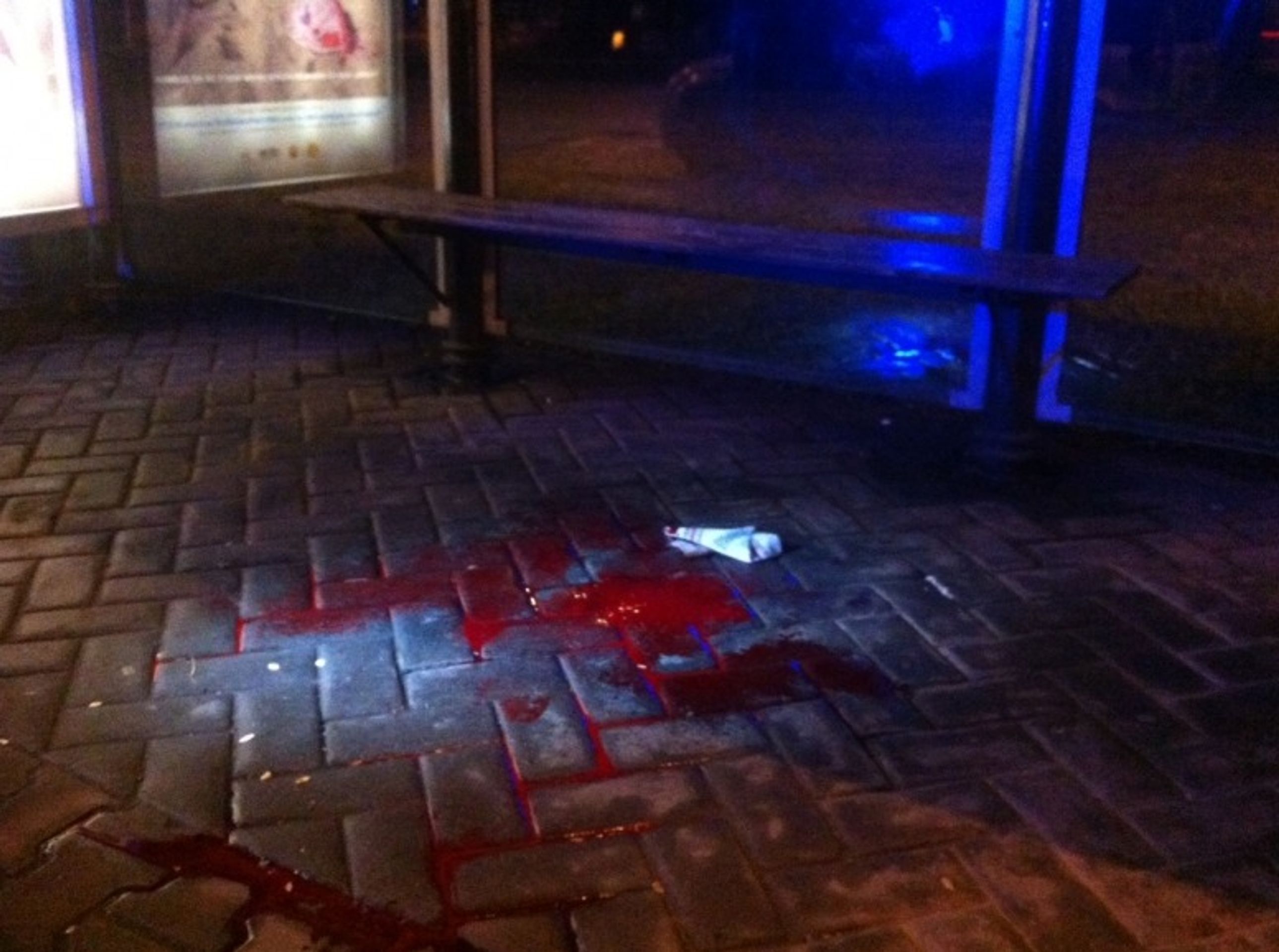 Zranění muže z Plzeňska - 3 - Záhadné zranění muže z Plzeňska (1/3)