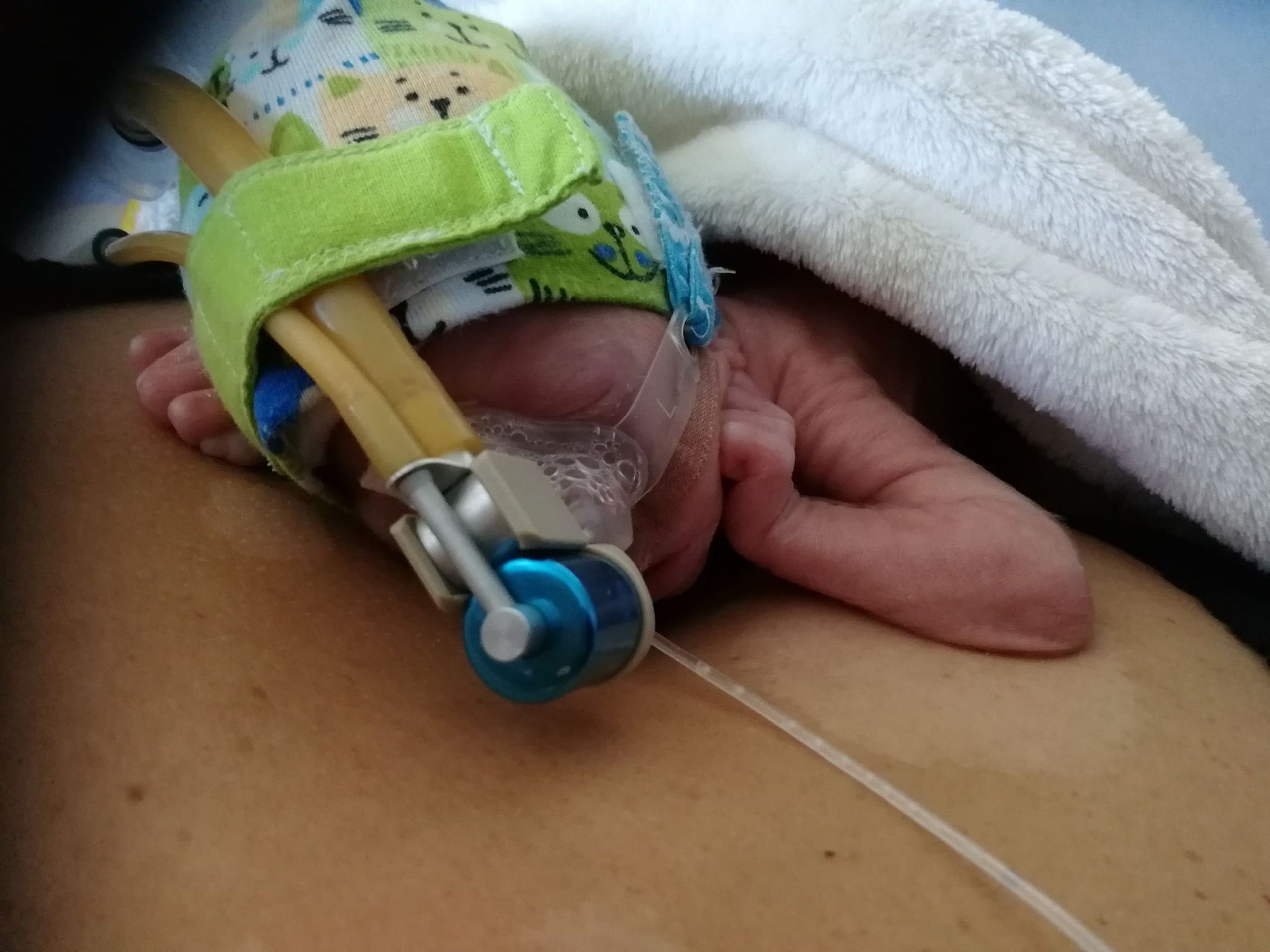 Jituška po porodu vážila 650 gramů - GALERIE: Malá Jituška vážila po porodu jen 650 gramů (3/5)