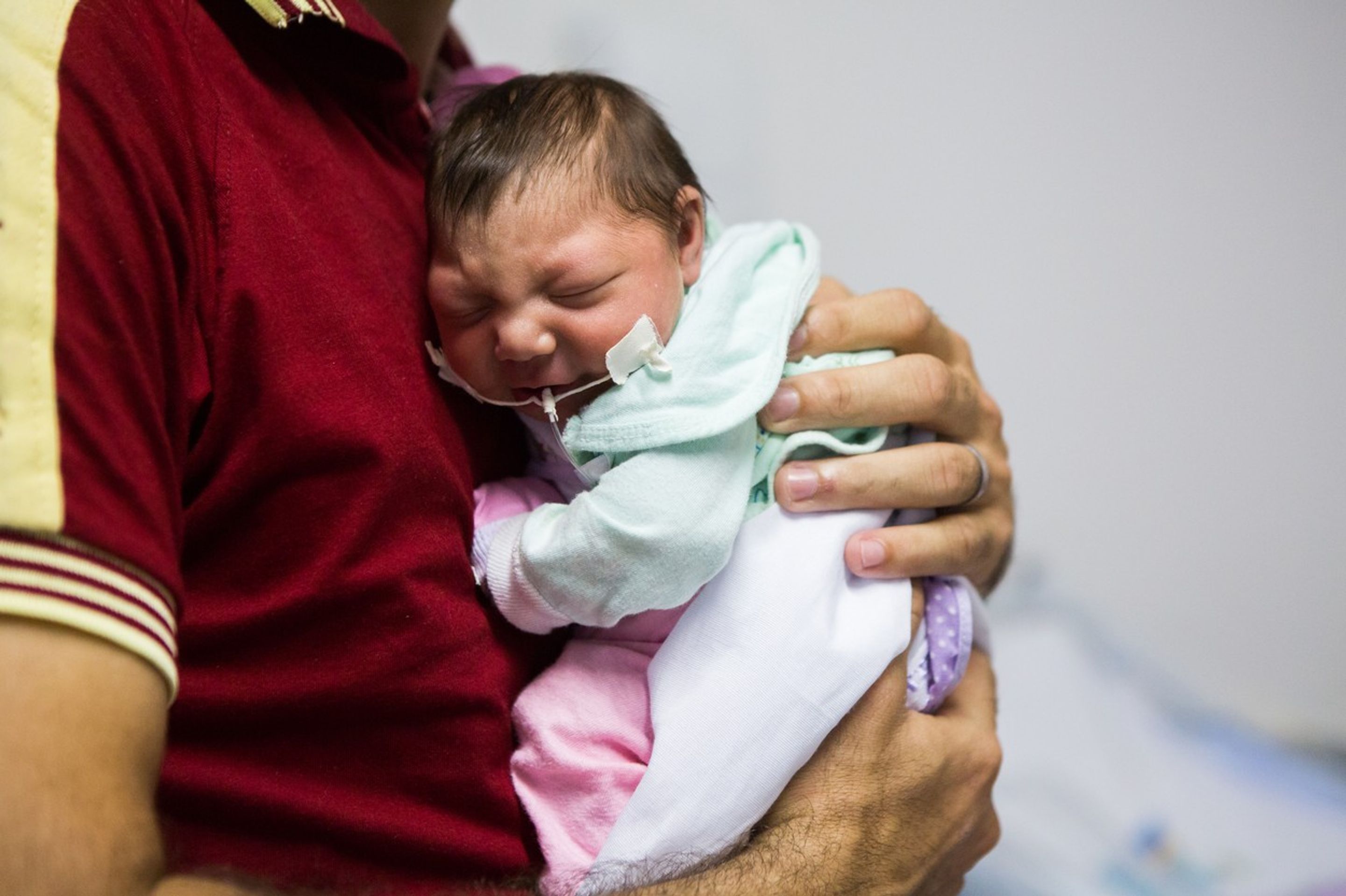 Virus Zika - postižené dítě 2 - GALERIE: Vir Zika (4/6)