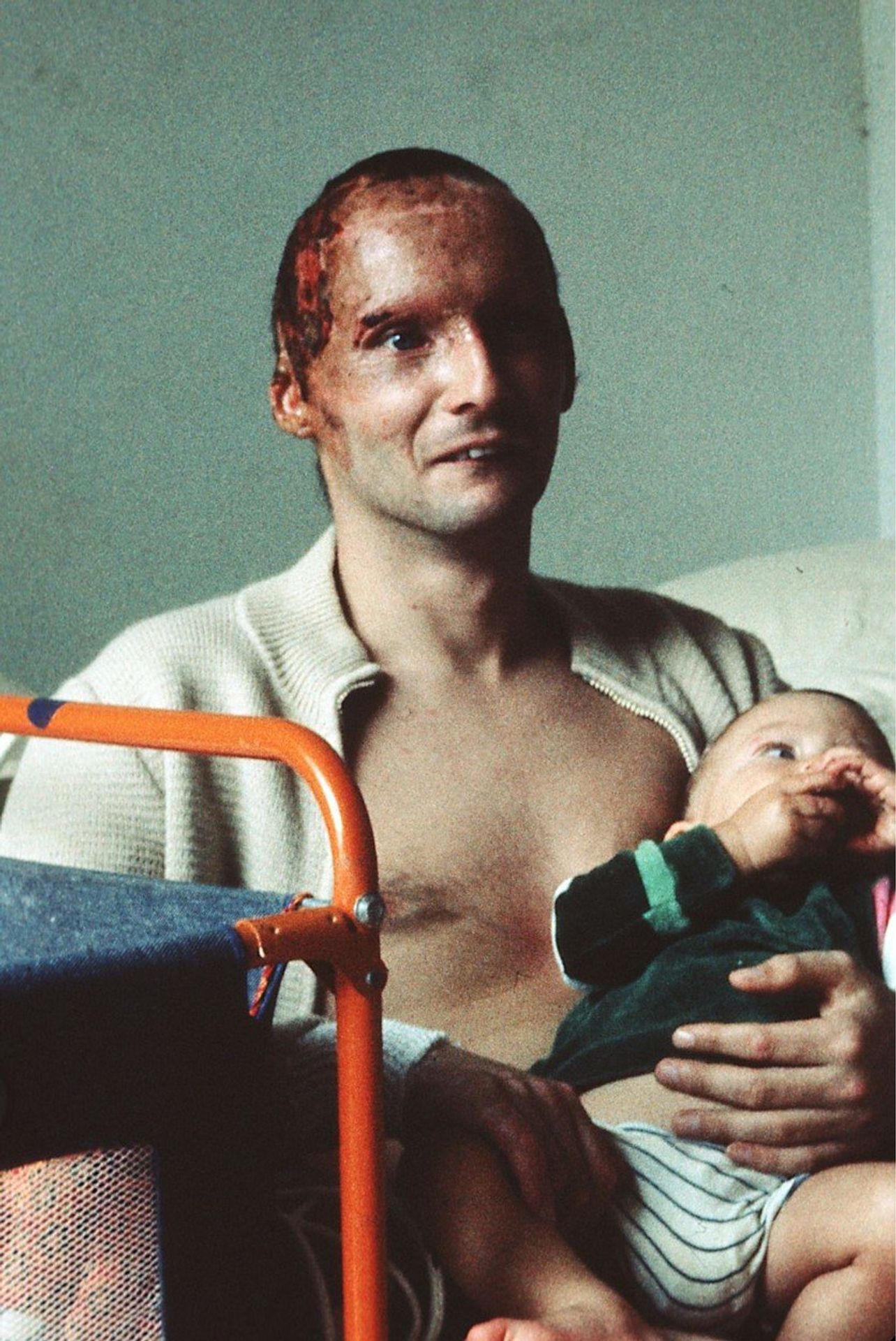Niki Lauda po nehodě v roce 1976 - GALERIE: Legendární závodník Niki Lauda zemřel ve věku 70 let (3/4)
