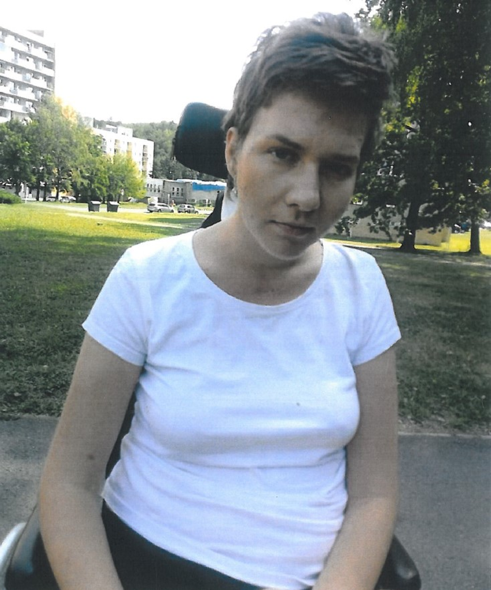 Fotografie po úrazu hlavy - Žena se těžce zranila na diskotéce v Novém Jičíně (4/5)