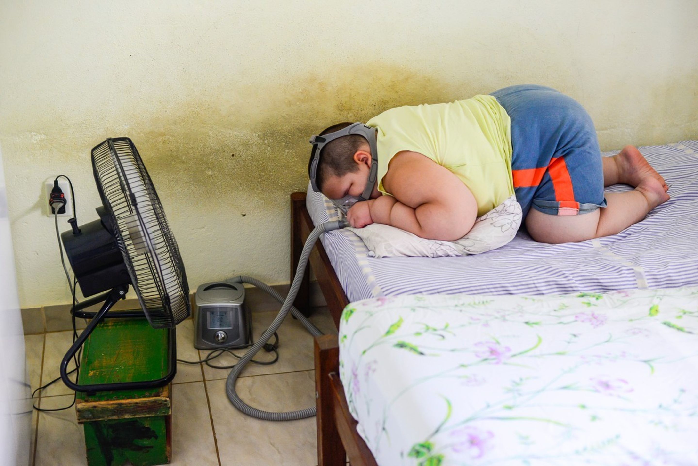 Pětiletý chlapec váží neuvěřitelných 80 kg - 4 - GALERIE: Pětiletý chlapec váží neuvěřitelných 80 kg (4/5)