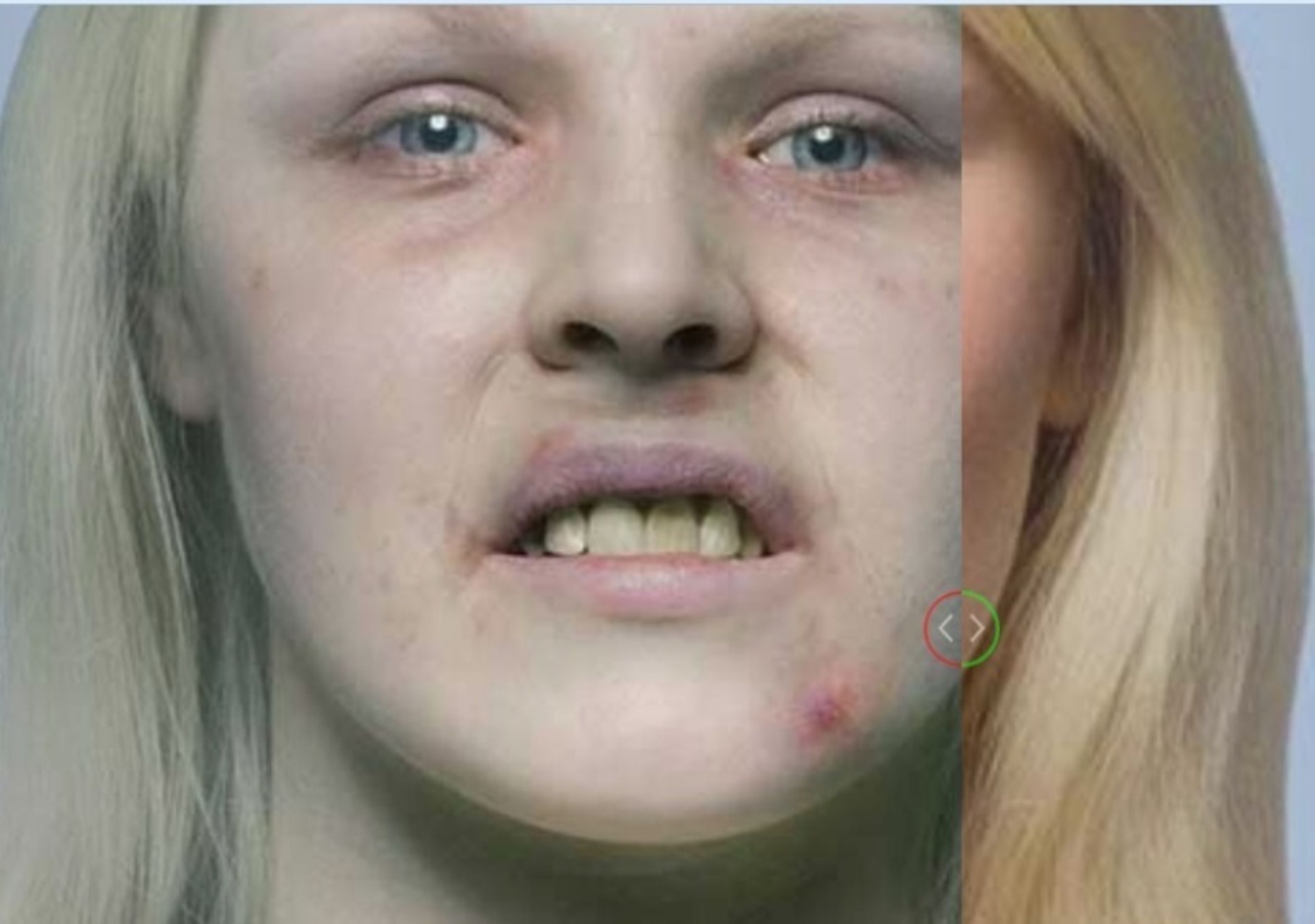 Studie: žena kuřačka x nekuřačka - 2 - GALERIE: Studie - žena kuřačka x nekuřačka (3/8)