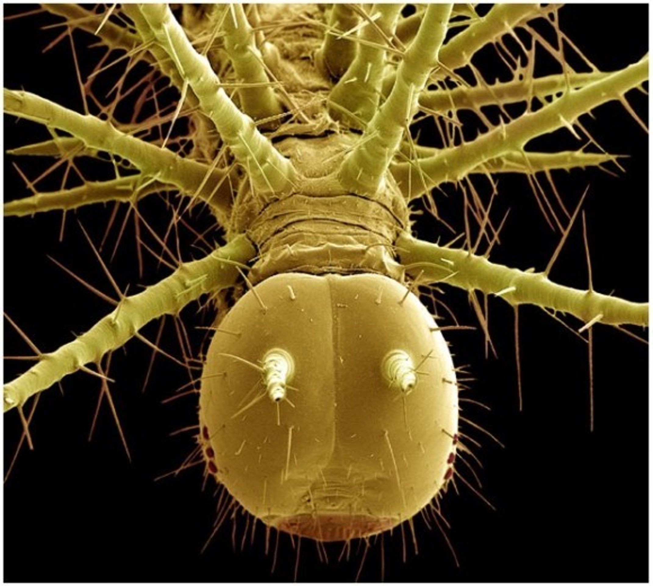 Hmyz pod elektronovým mikroskopem - 18 - GALERIE: Hmyz pod elektronovým mikroskopem (4/20)