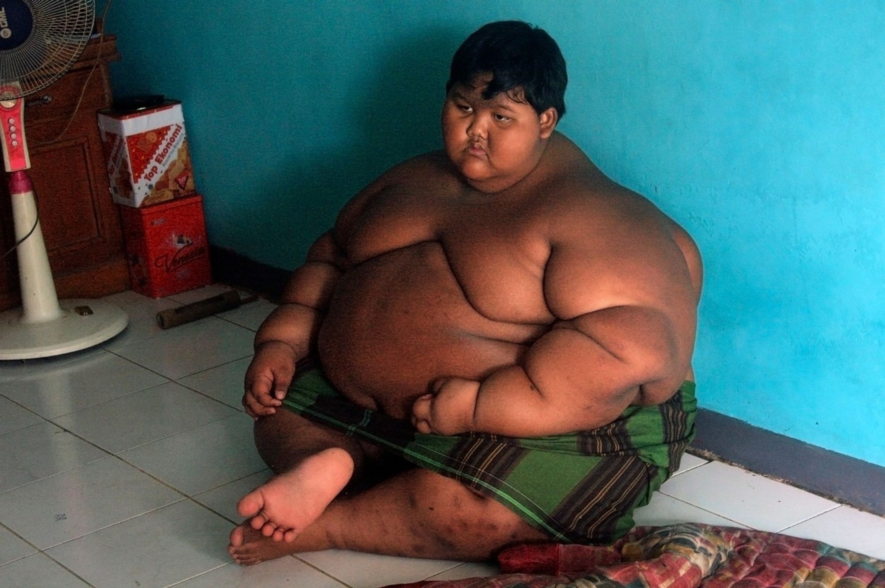 Desetiletý chlapec váží 192 kg - 3 - Nejtlustší dítě na světě zhublo (5/7)