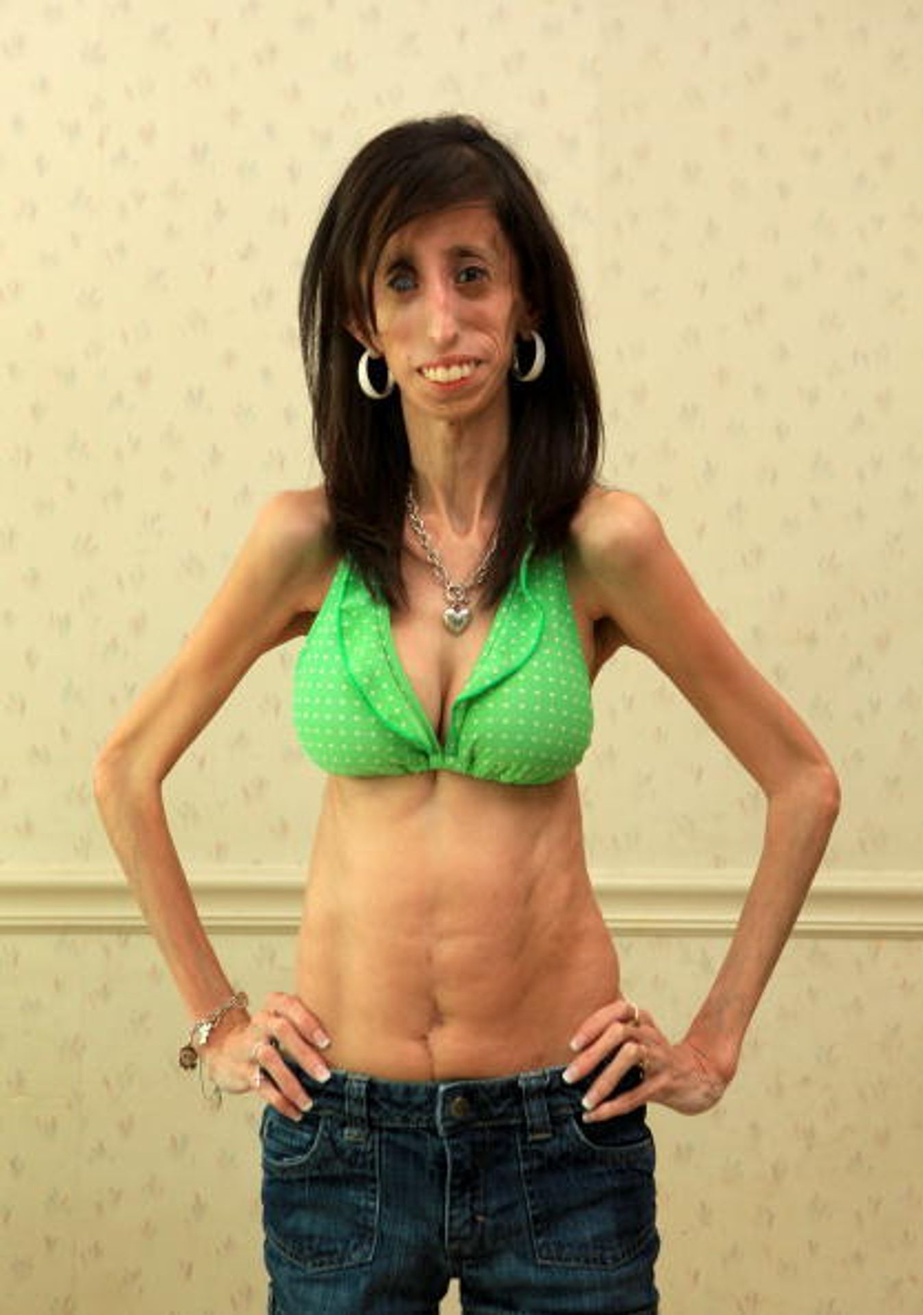 Lizzie Velasquezová - 6 - Lizzie Velasquez (3/7)