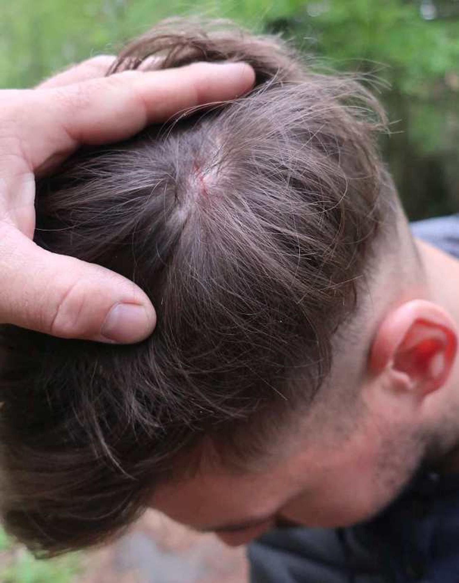 Na běžce v Plzni zaútočil dravec - GALERIE: Na běžce v Plzni zaútočil dravec (1/3)