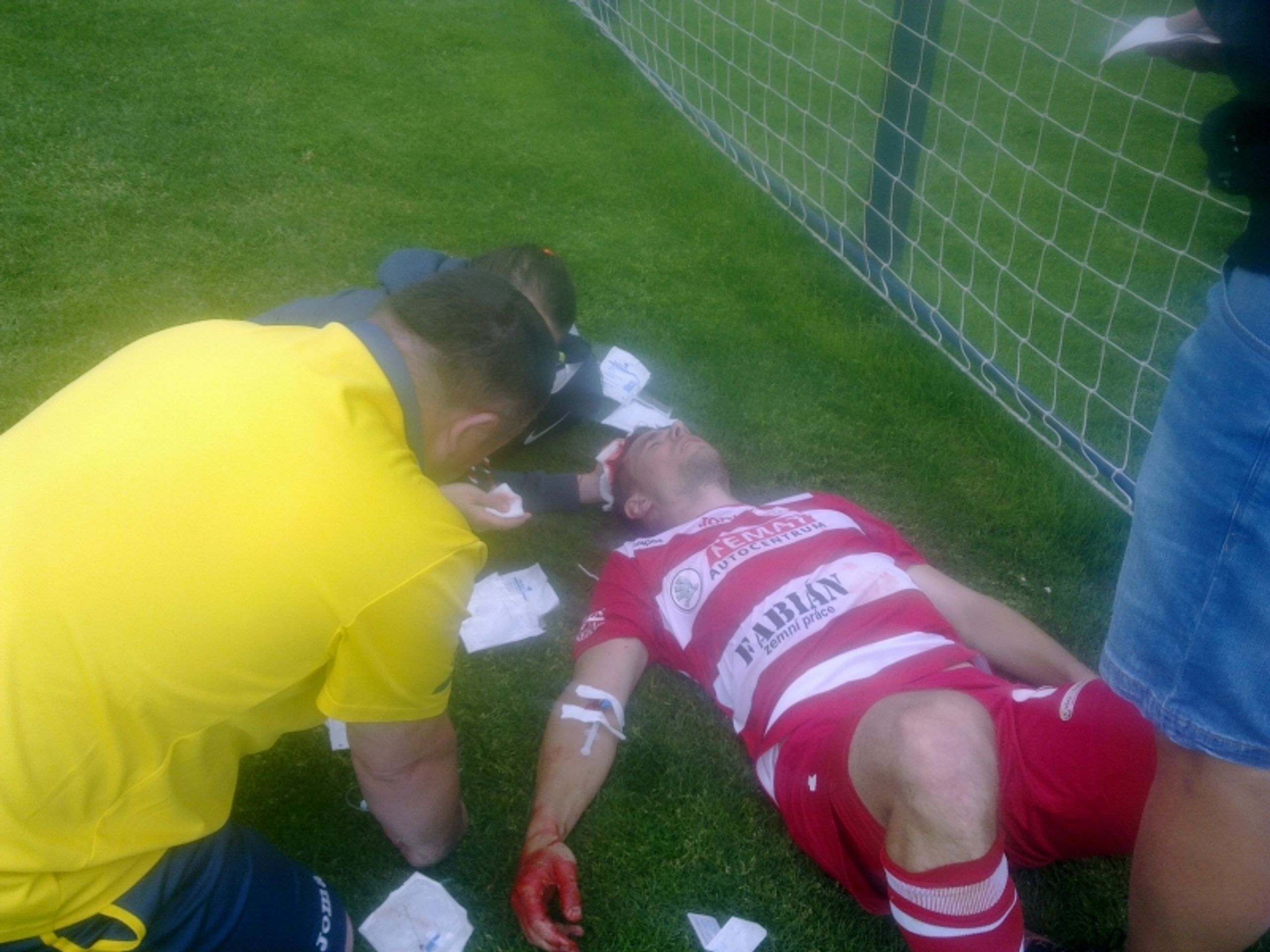 Zraněný kapitán Štěchovic - GALERIE: Fotbalista utrpěl zlomeninu lebky a čtyř obratlů (3/4)