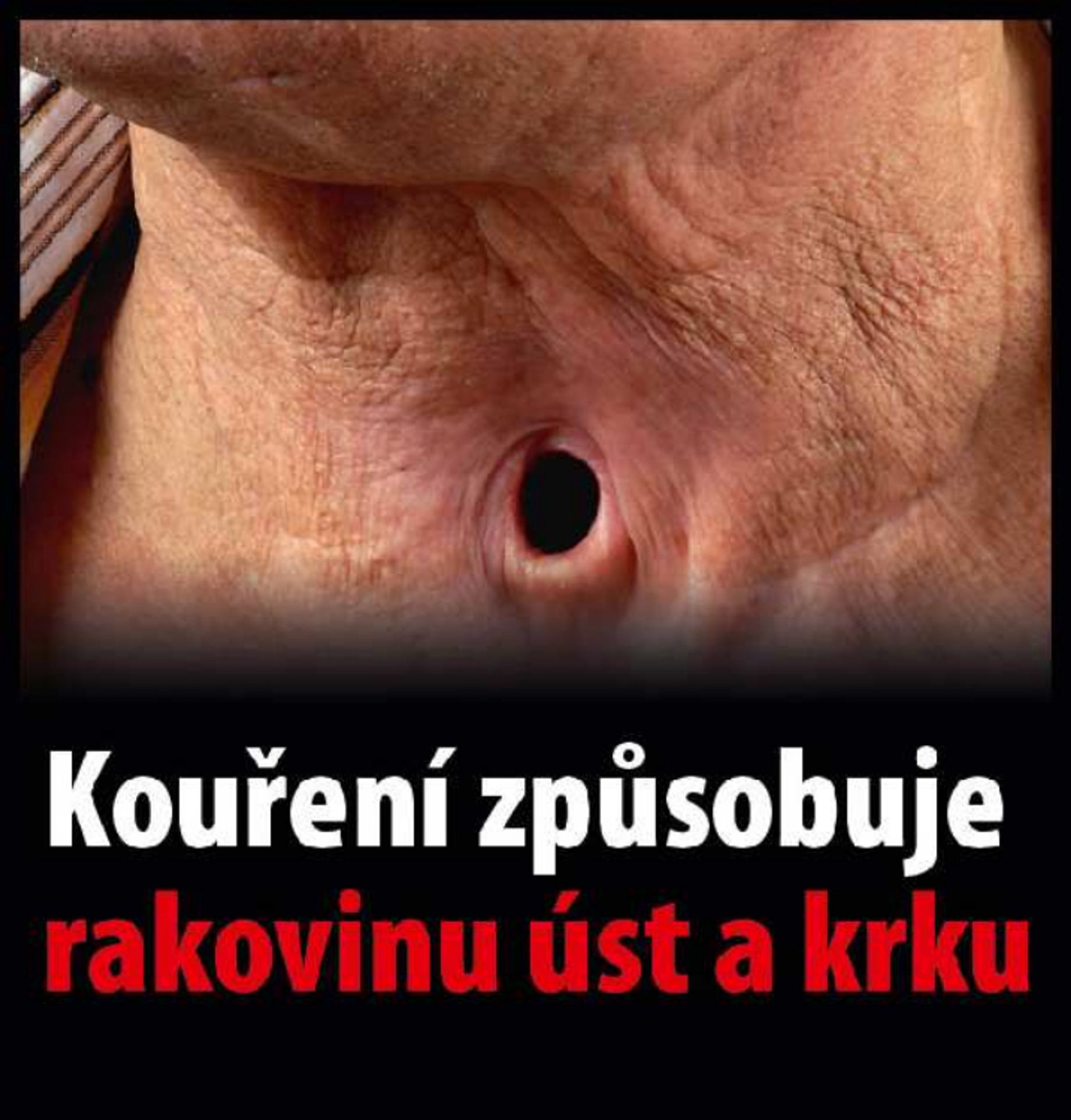 Varovné obrázky na krabičkách cigaret - 12 - GALERIE: Varovné obrázky na krabičkách cigaret (12/42)
