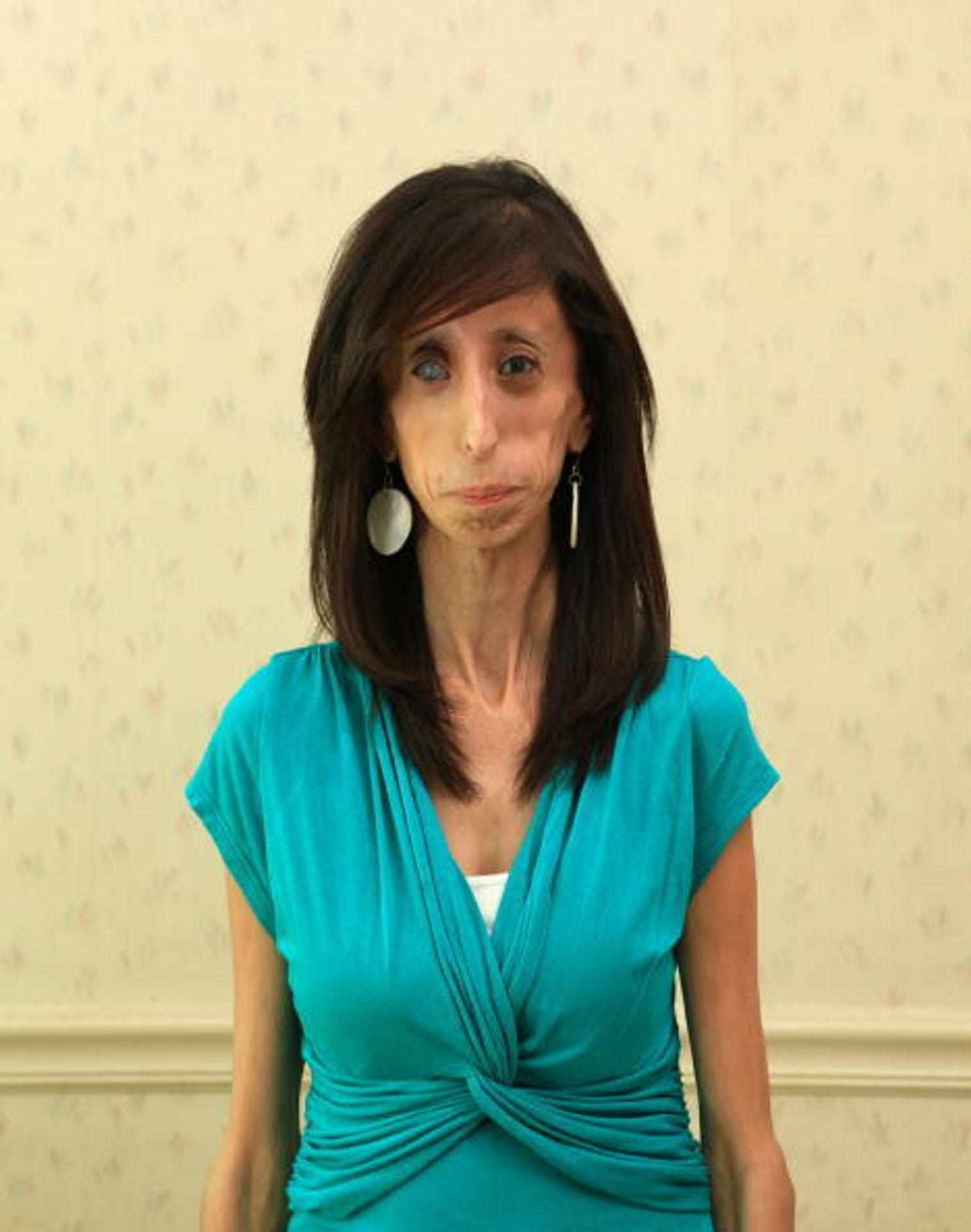 Lizzie Velasquezová - 5 - Lizzie Velasquez (2/7)