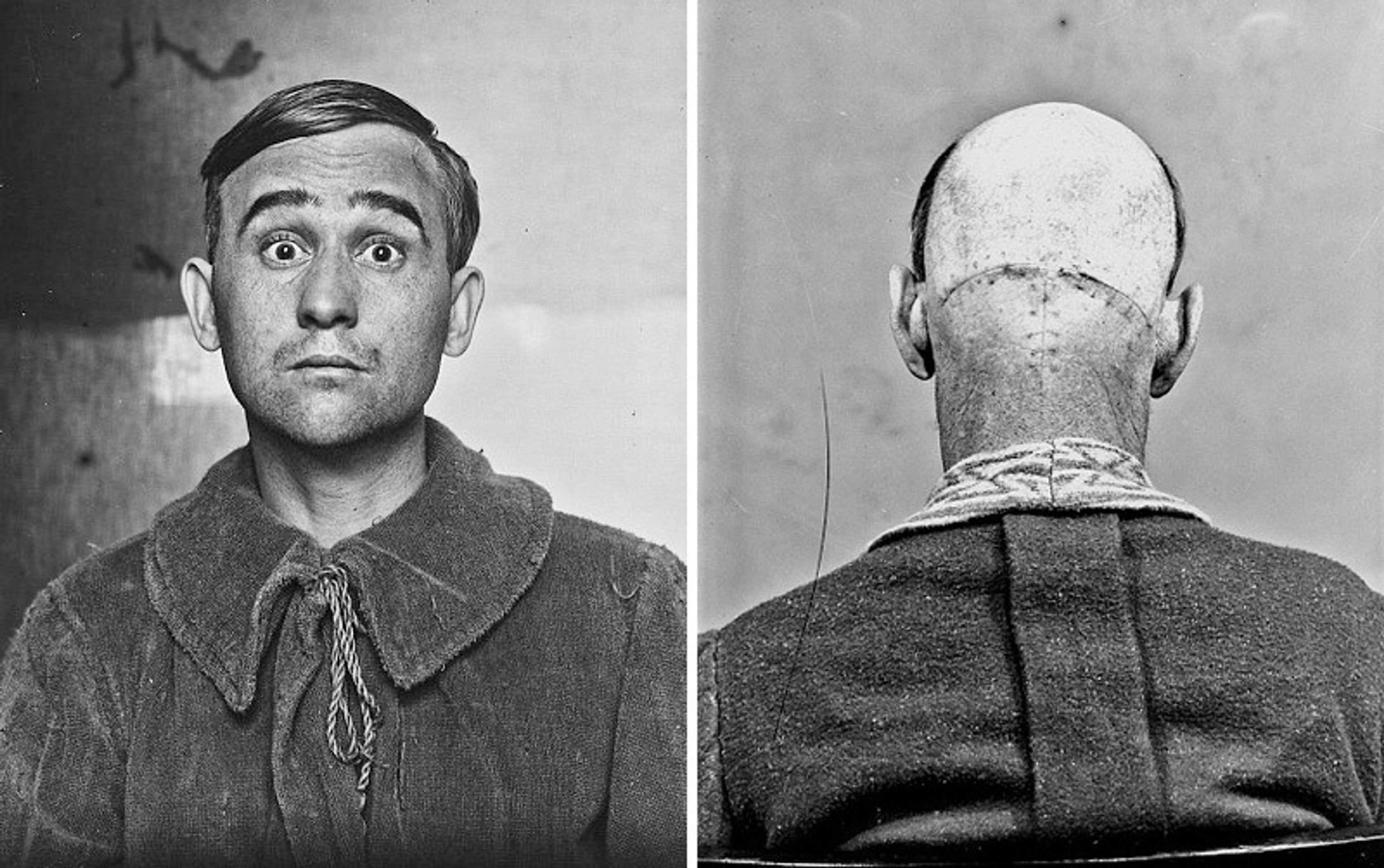 Operace mozku v historii - 5 - GALERIE: Šokující fotografie operací mozku (6/10)