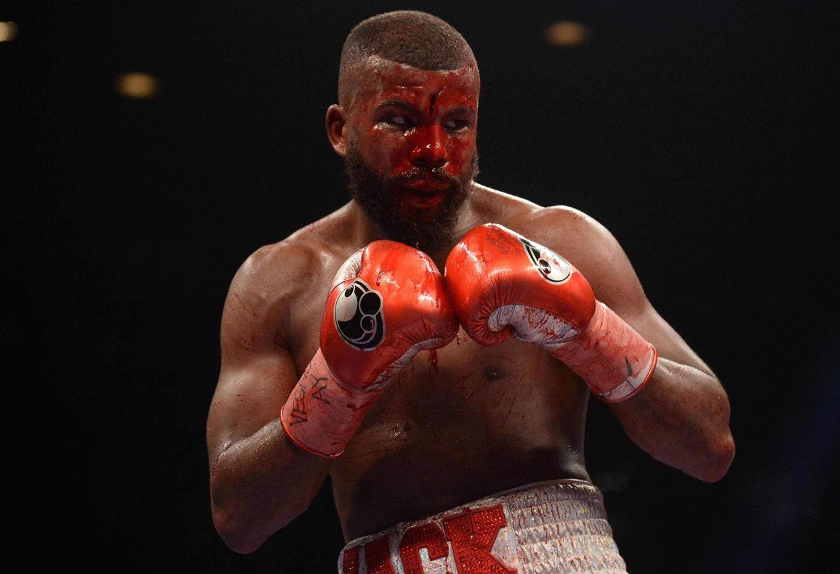 Badou Jack - GALERE: Badou Jack utrpěl v zápase hrozivé zranění hlavy (3/6)
