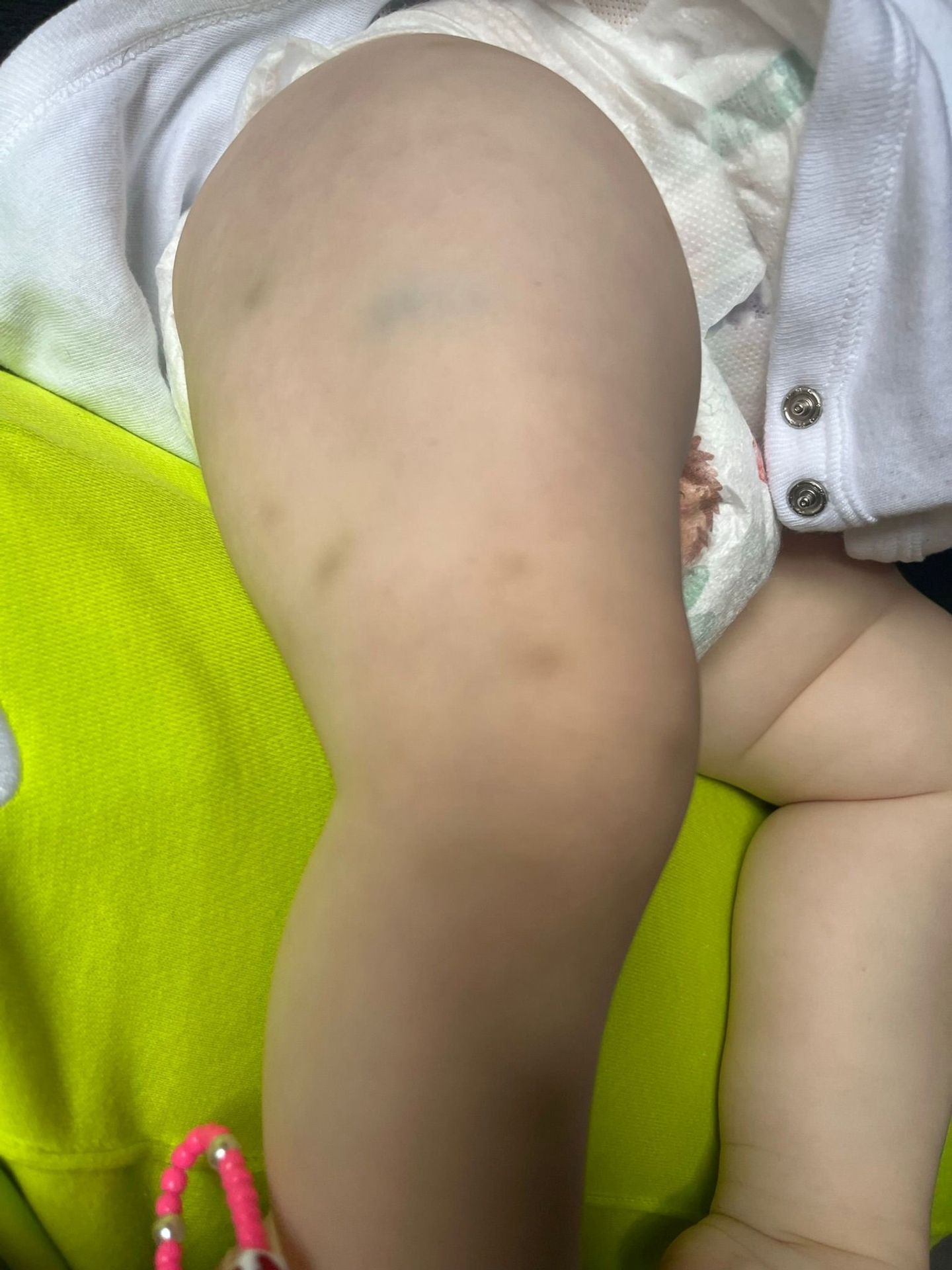 Leukémie Bailey - Baileymu byla diagnostikována leukémie (2/5)