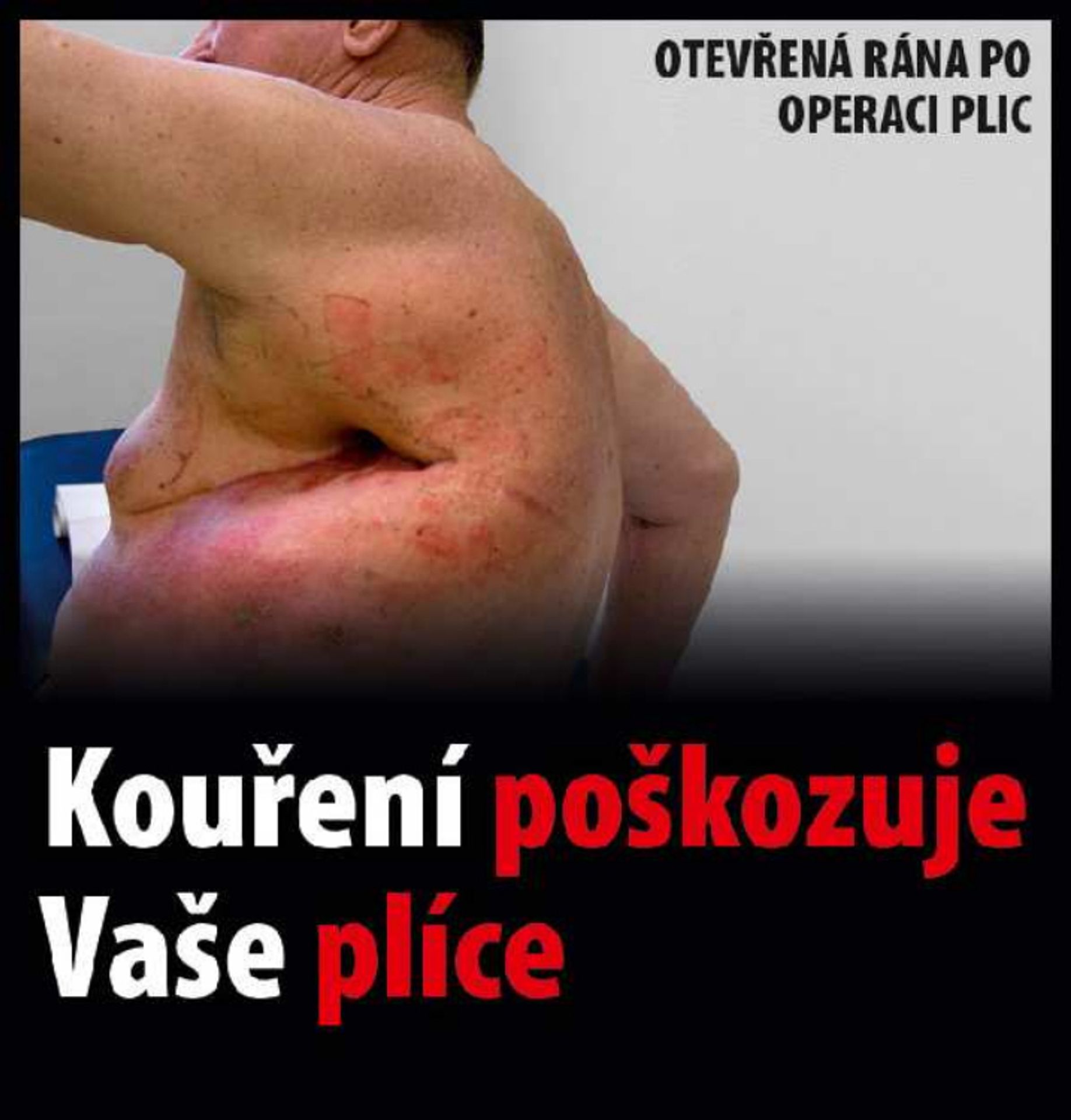 Varovné obrázky na krabičkách cigaret - 9 - GALERIE: Varovné obrázky na krabičkách cigaret (9/42)