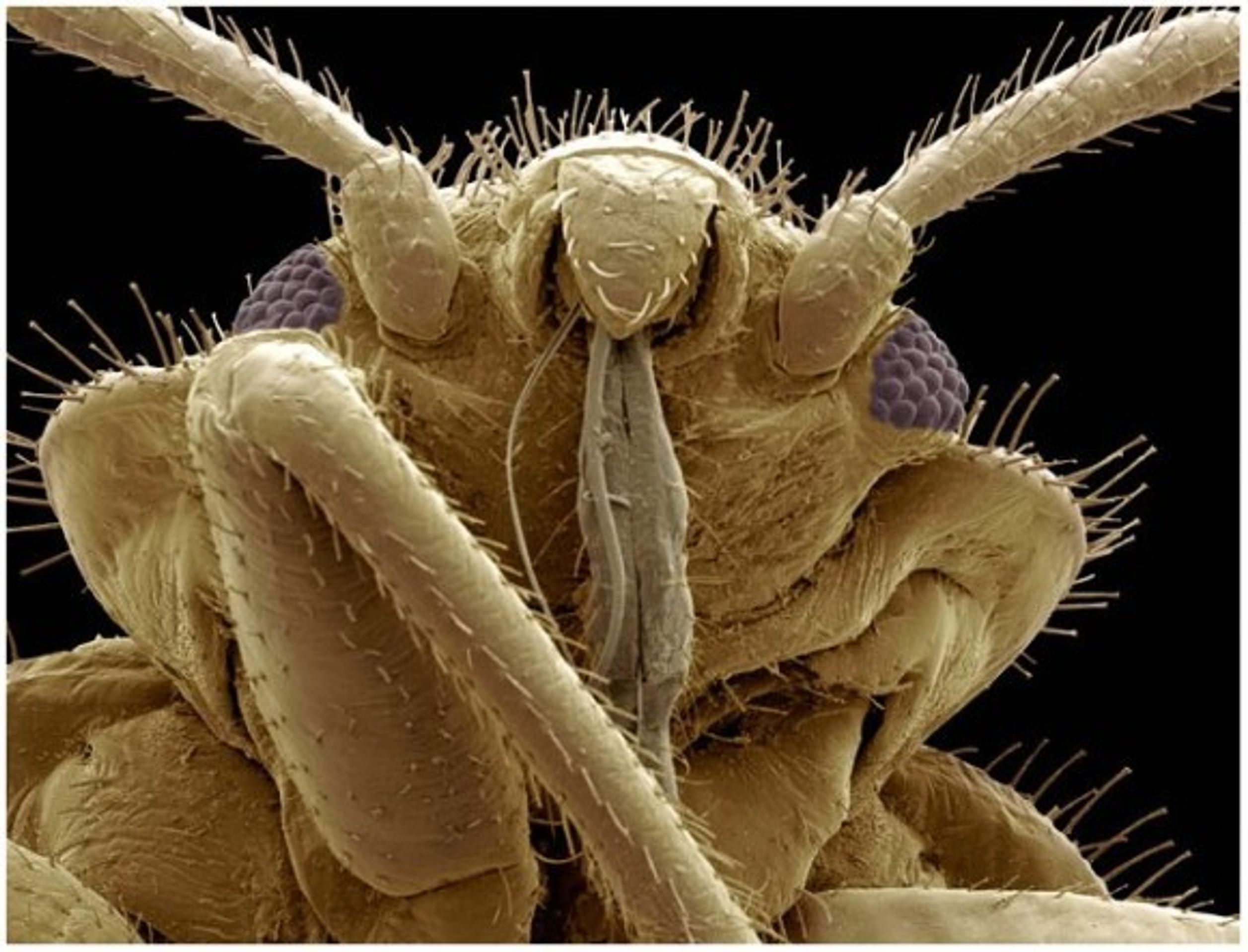 Hmyz pod elektronovým mikroskopem - 4 - GALERIE: Hmyz pod elektronovým mikroskopem (18/20)