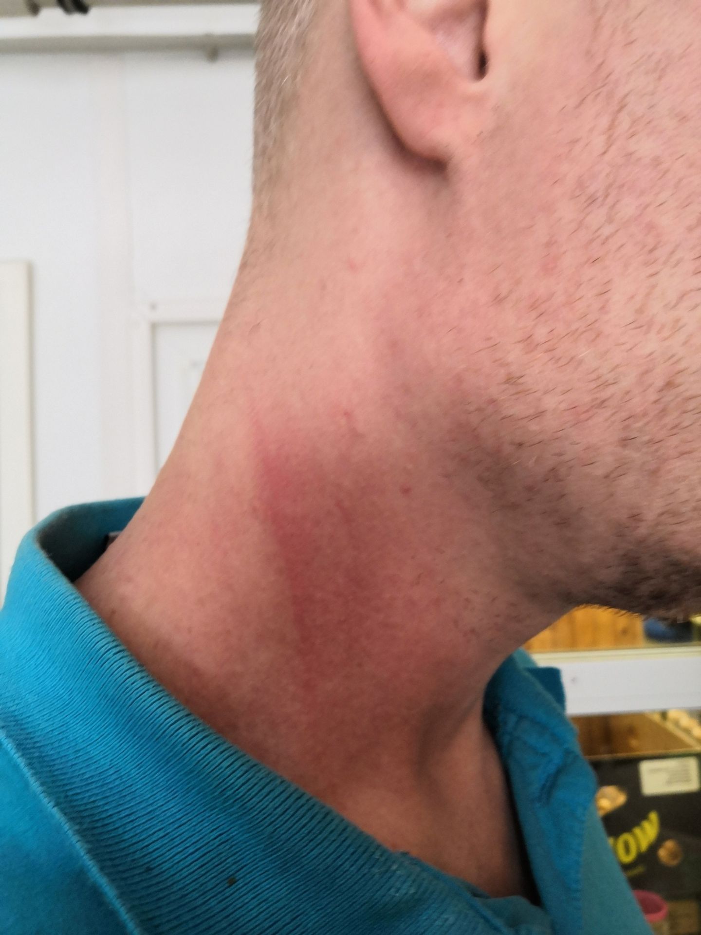 Napadení sociálního pracovníka Městskou policií - 2 - GALERIE: Údajné napadení sociálního pracovníka Městskou policií (2/4)