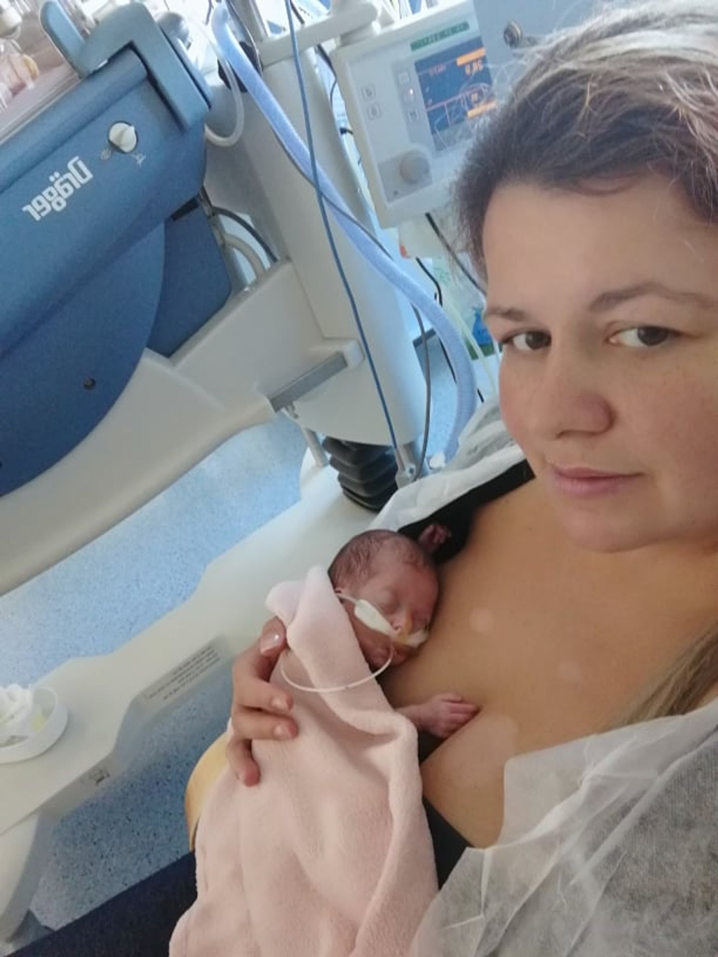 Jituška po porodu vážila 650 gramů - GALERIE: Malá Jituška vážila po porodu jen 650 gramů (5/5)