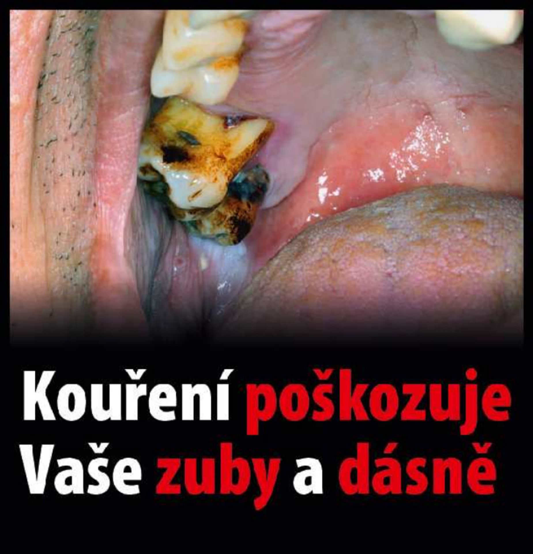 Varovné obrázky na krabičkách cigaret - 41 - GALERIE: Varovné obrázky na krabičkách cigaret (41/42)