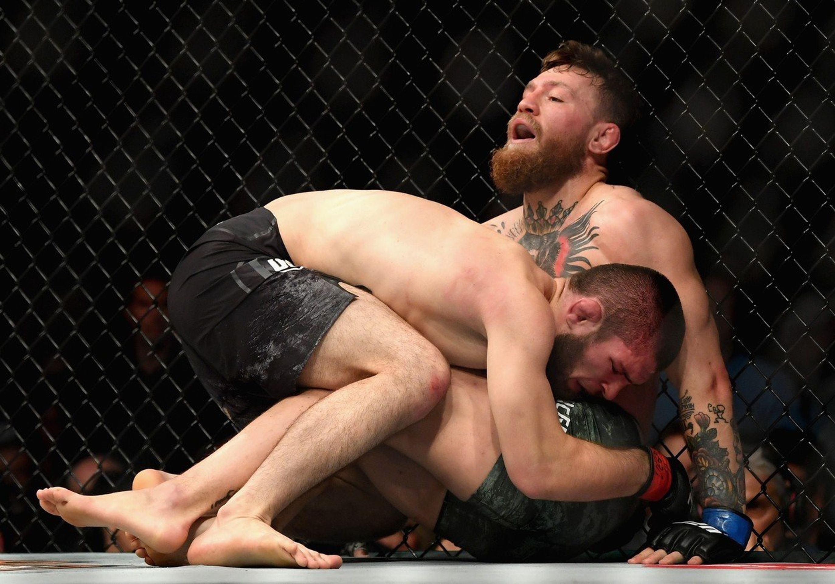 Conor McGregor - GALERIE: Takto vypadal McGregor před a po zápase s Khabibem (7/9)