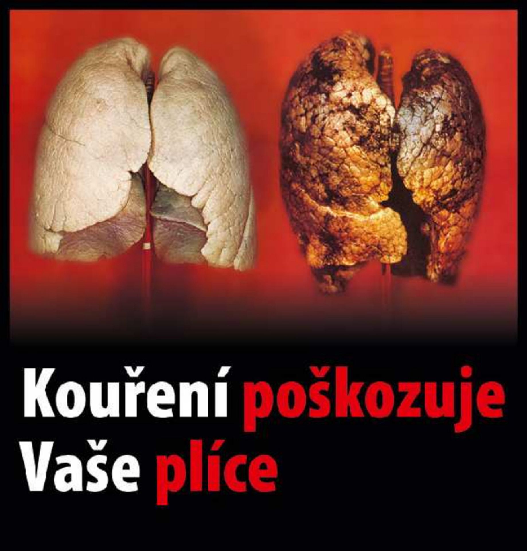Varovné obrázky na krabičkách cigaret - 25 - GALERIE: Varovné obrázky na krabičkách cigaret (25/42)