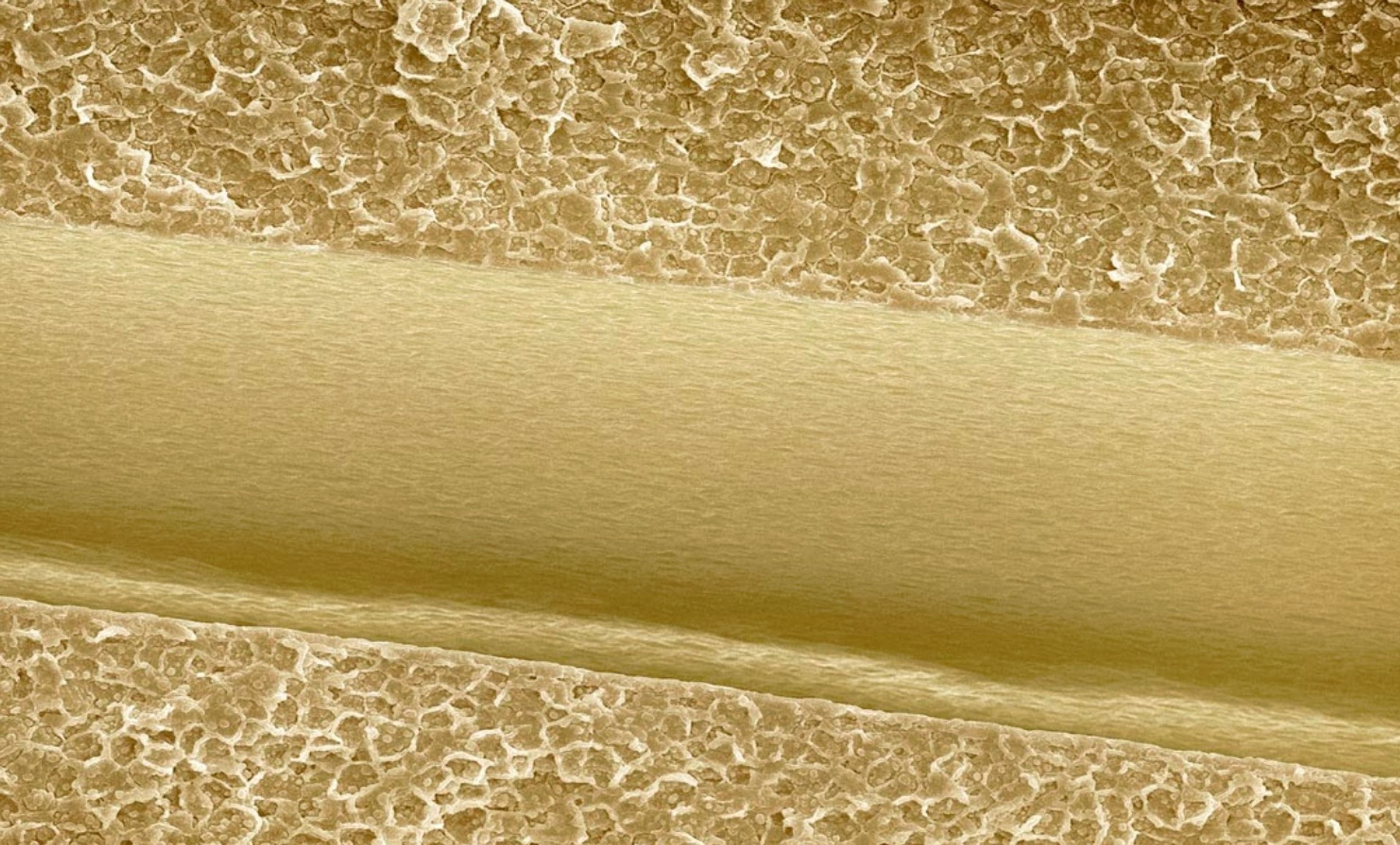 Jídlo pod elektromikroskopem - 12 - GALERIE: Jídlo pod elektronovým mikroskopem (9/20)