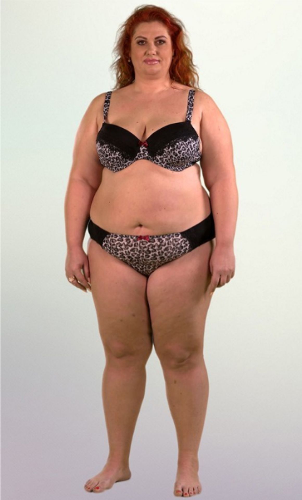 Miriam - 2 - GALERIE: Miriam na konci hubnutí - shodila 45 kilo (3/5)